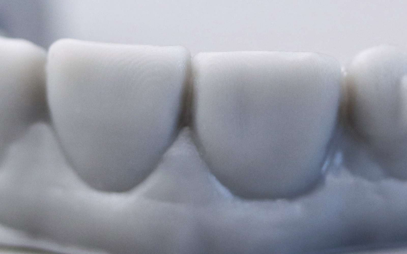 Фотополимер Gorky Liquid Dental Model LCD Gray (1 кг)