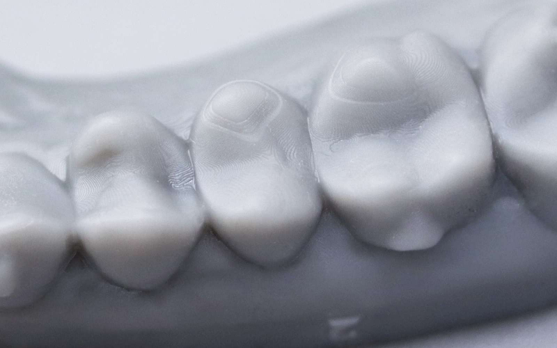 Фотополимер Gorky Liquid Dental Model LCD Gray (1 кг)