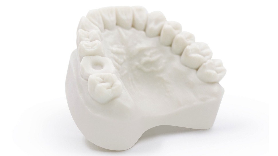 HARZ Labs Dental Model Resin Bone Print 2