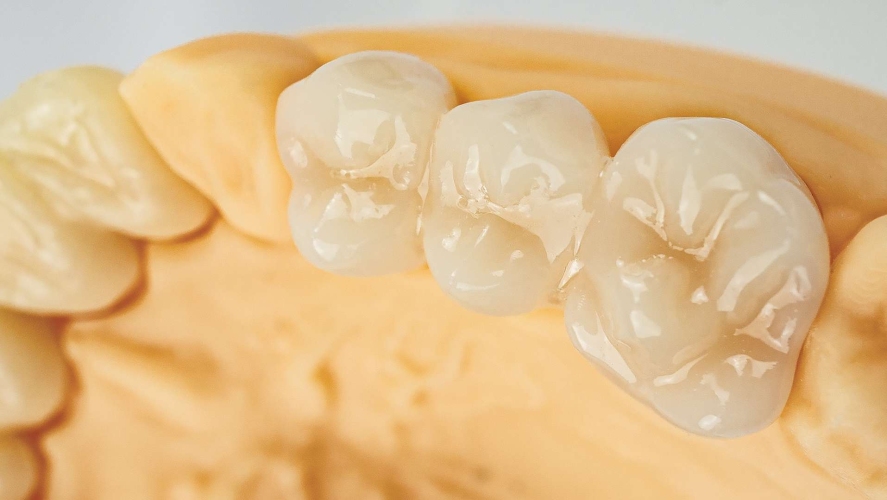 HARZ Labs Dental Glaze — высокоглянцевая УФ-отверждаемая глазурь для временных реставраций 10 мл