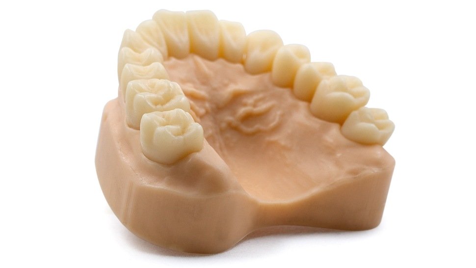 HARZ Labs Dental Model Resin Beige Print 2