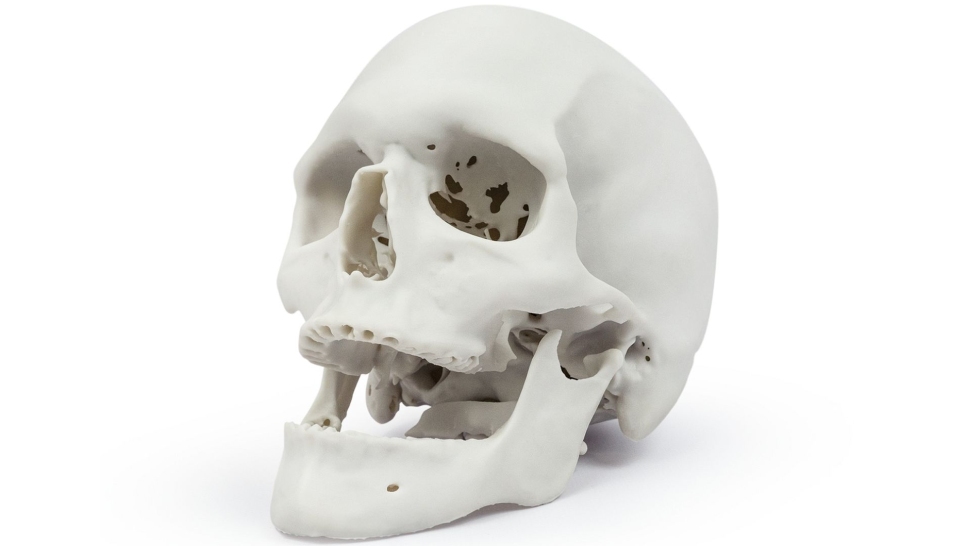 HARZ-Labs-Demo-Bone-Model2