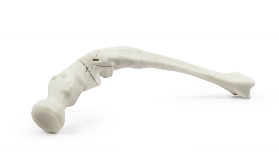 HARZ-Labs-Demo-Bone-Model1