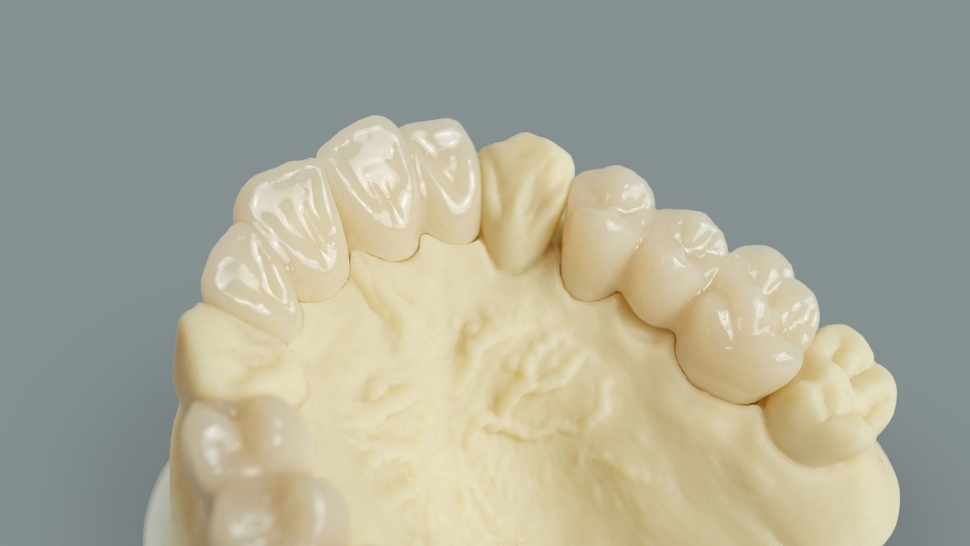 HARZ-Labs-Dental-Ivory-Model4