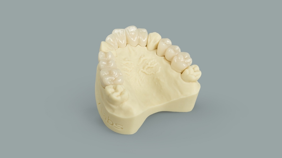 HARZ-Labs-Dental-Ivory-Model3
