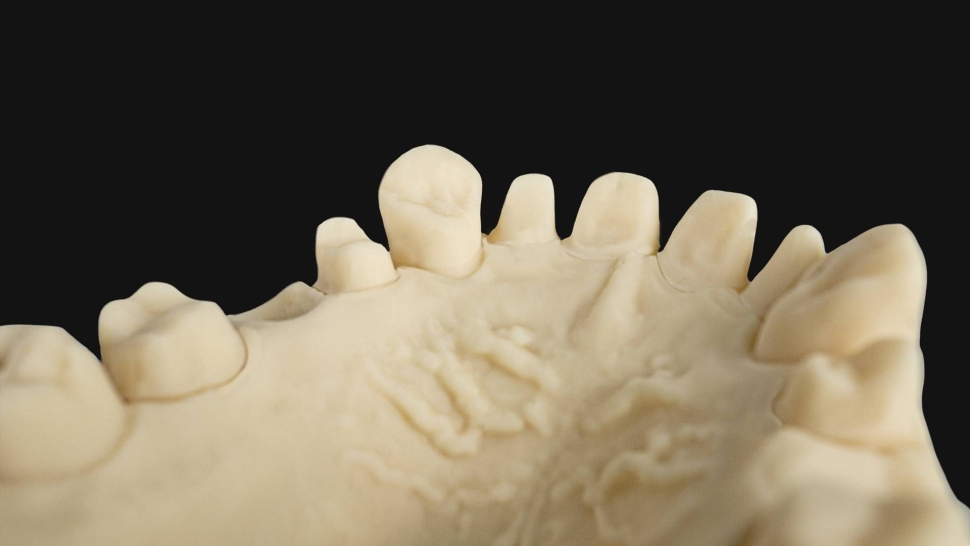 HARZ-Labs-Dental-Ivory-Model5
