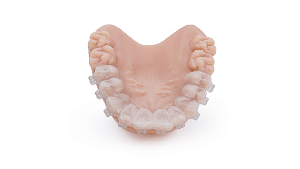 HARZ Labs Dental IBT Model 1